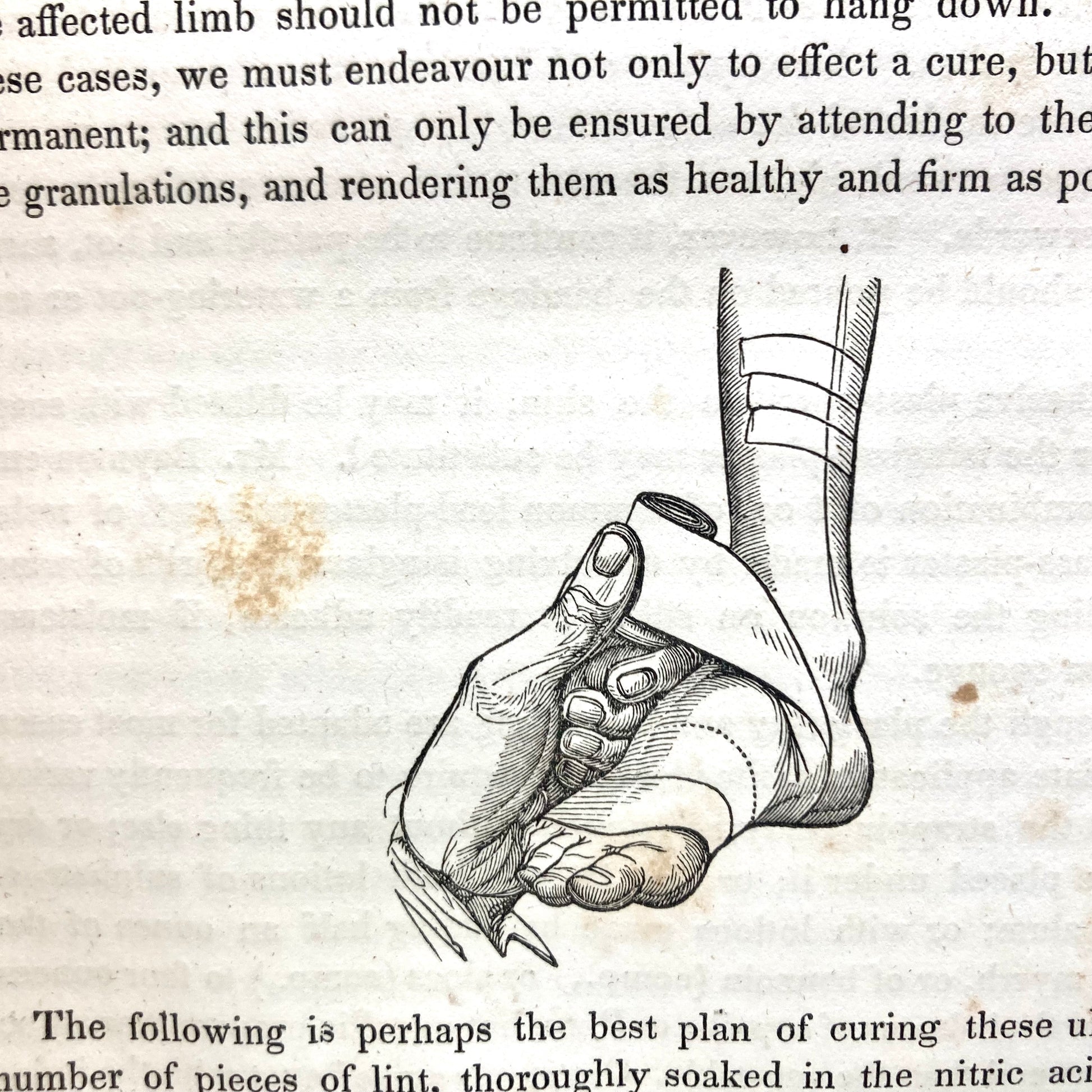 DRUITT, Robert "The Principles and Practice of Modern Surgery" [Lea & Blanchard, 1842] - Buzz Bookstore