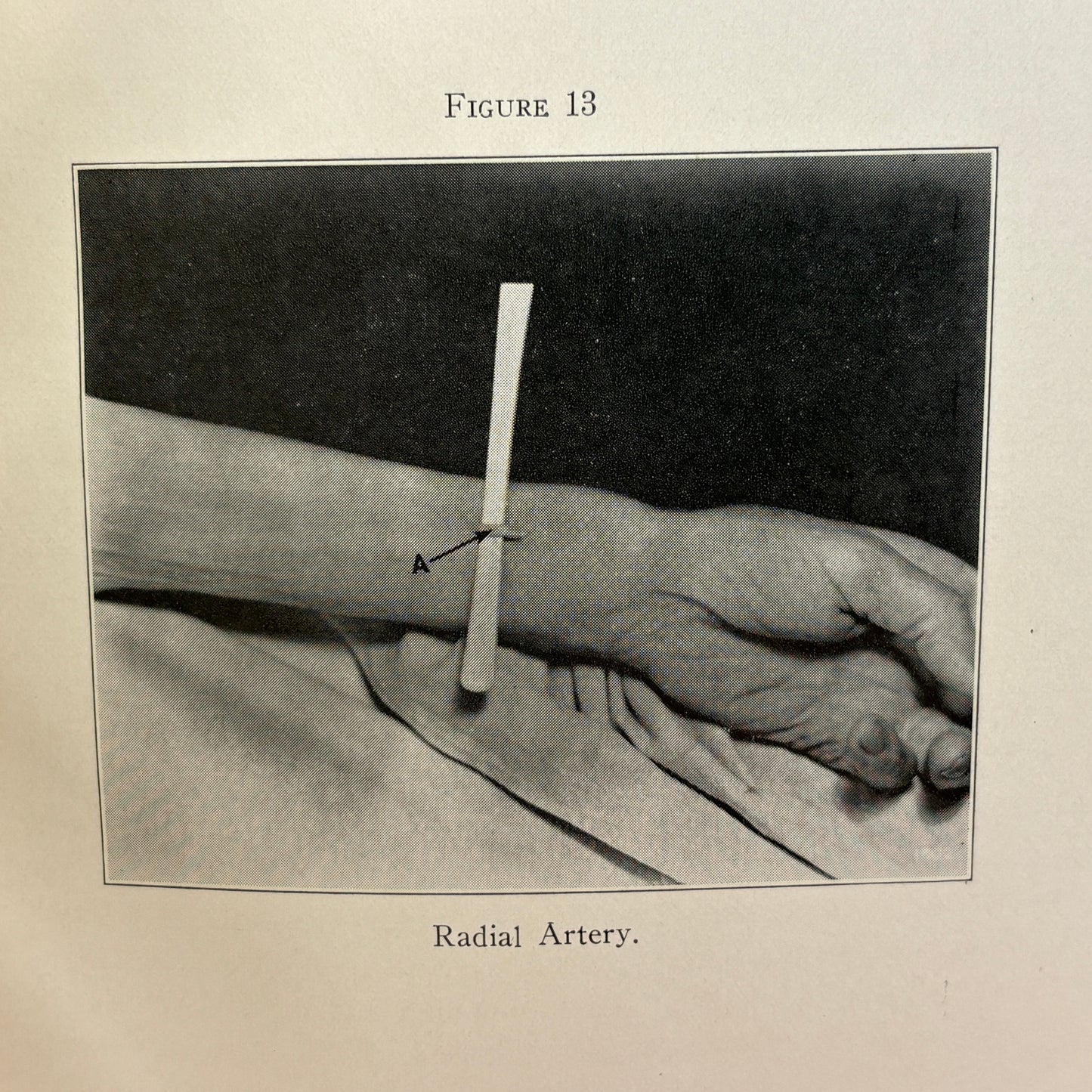 SPRIGGS, A. O. "Champion Textbook on Embalming" [The Champion Co, 1933]